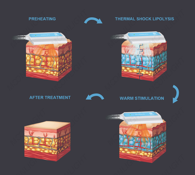 moonlight-四方冷热详情-04