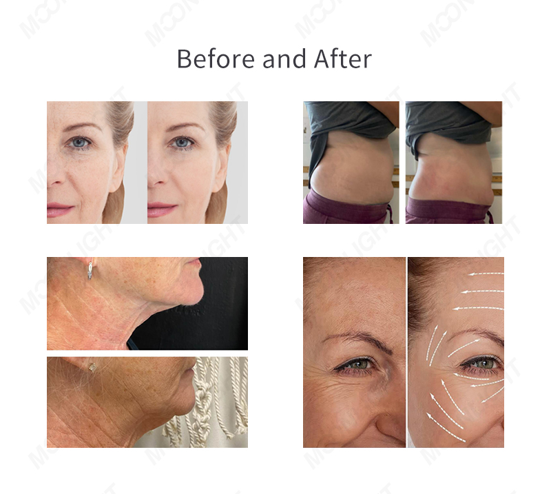 moonlight-四方冷热详情-05