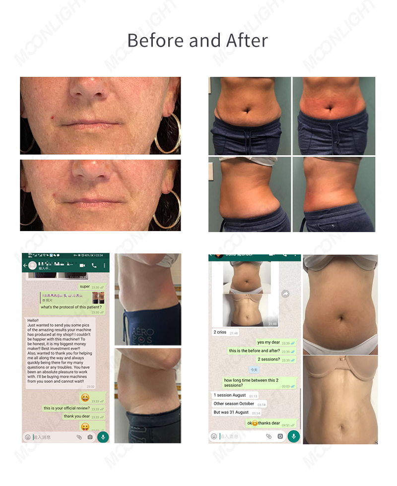 moonlight-四方冷热详情-10