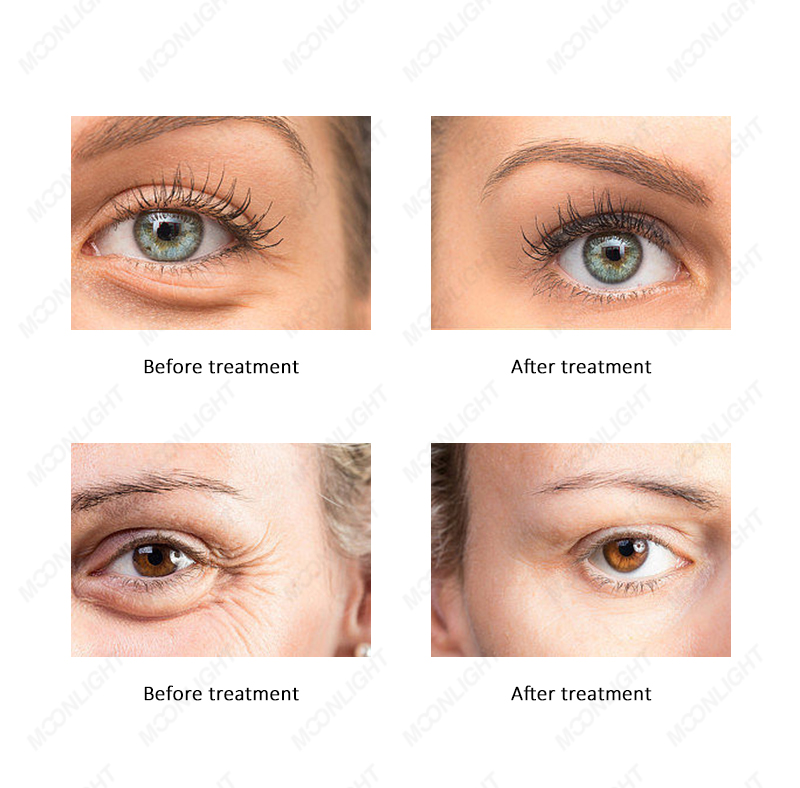 moonlight-滚轴详情-06