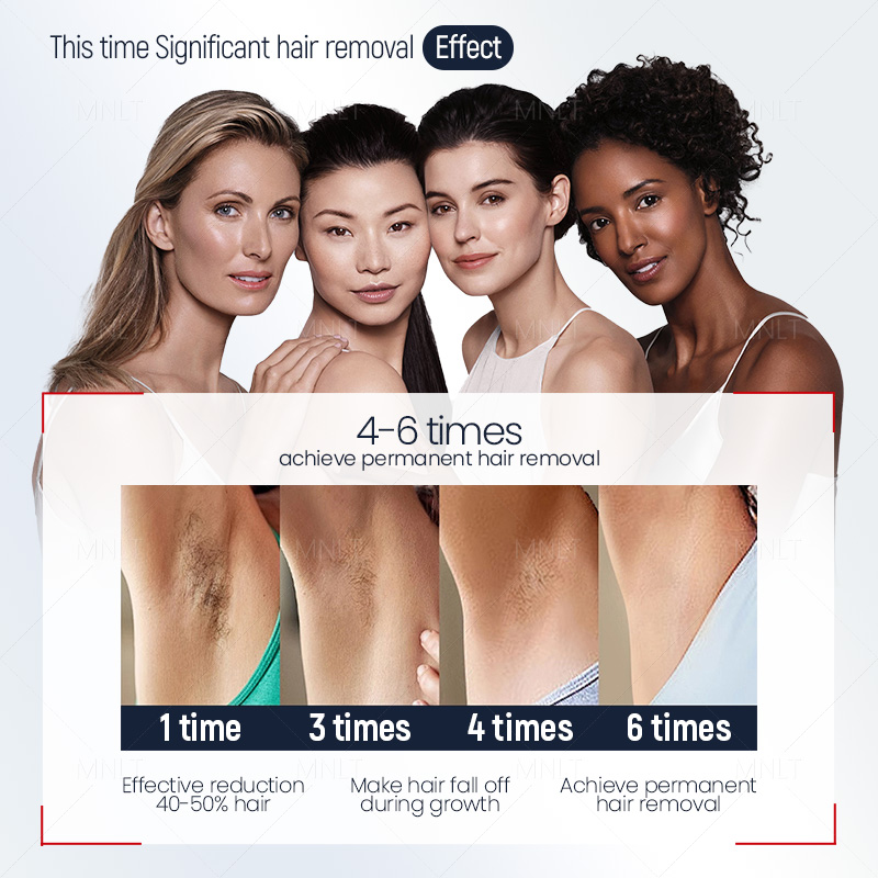 便携脱毛_08-压