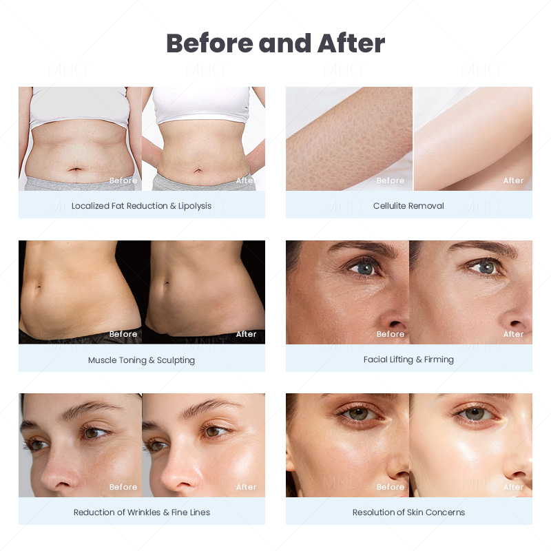 冷热+爆脂详情_10