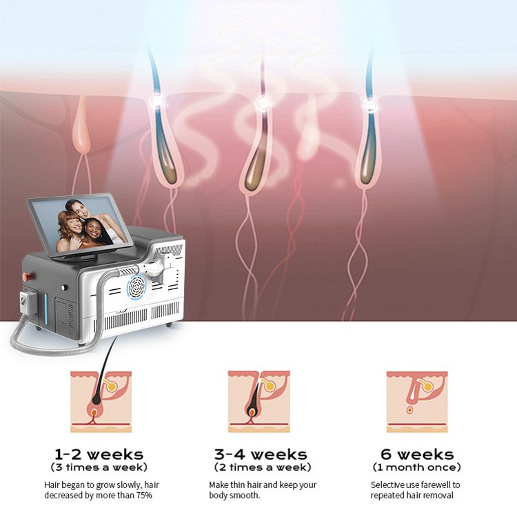 脱毛T6详情汇总-08