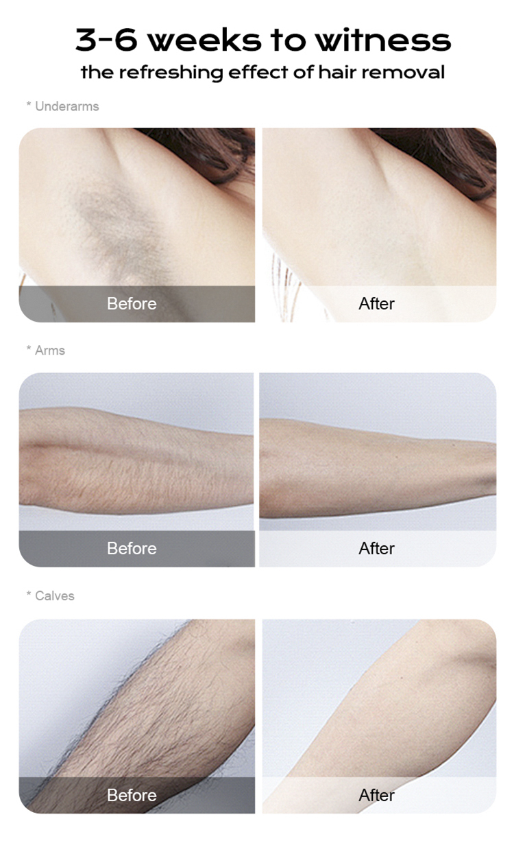 脱毛T6详情汇总-09